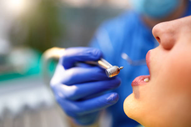 Best Teeth Whitening  in Seyur, MO